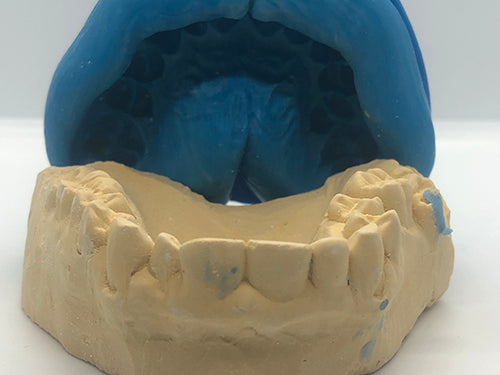 Replacement Impression Kit