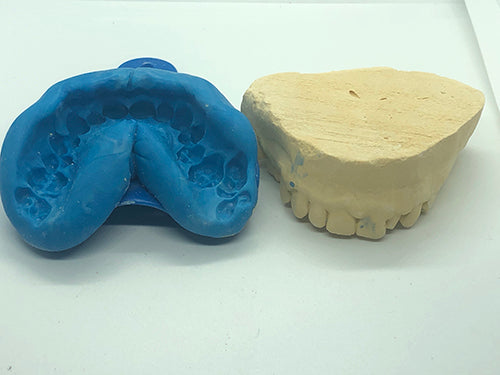 Replacement Impression Kit